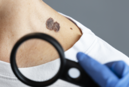 Skin Cancer Screenings are Important ALL YEAR - Veterans Outreach Ministries - Delaware