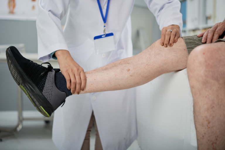 Summer Survival Guide for Varicose Veins and Other Vein Issues Summer Survival Guide for Varicose Veins and Other Vein Issues